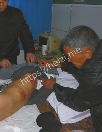 山东虐待亲子致死案